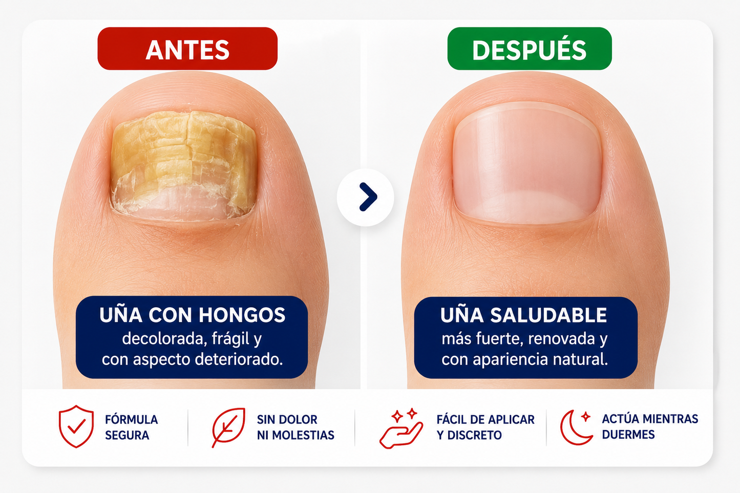 Parches Para Hongos En Uñas 🍄